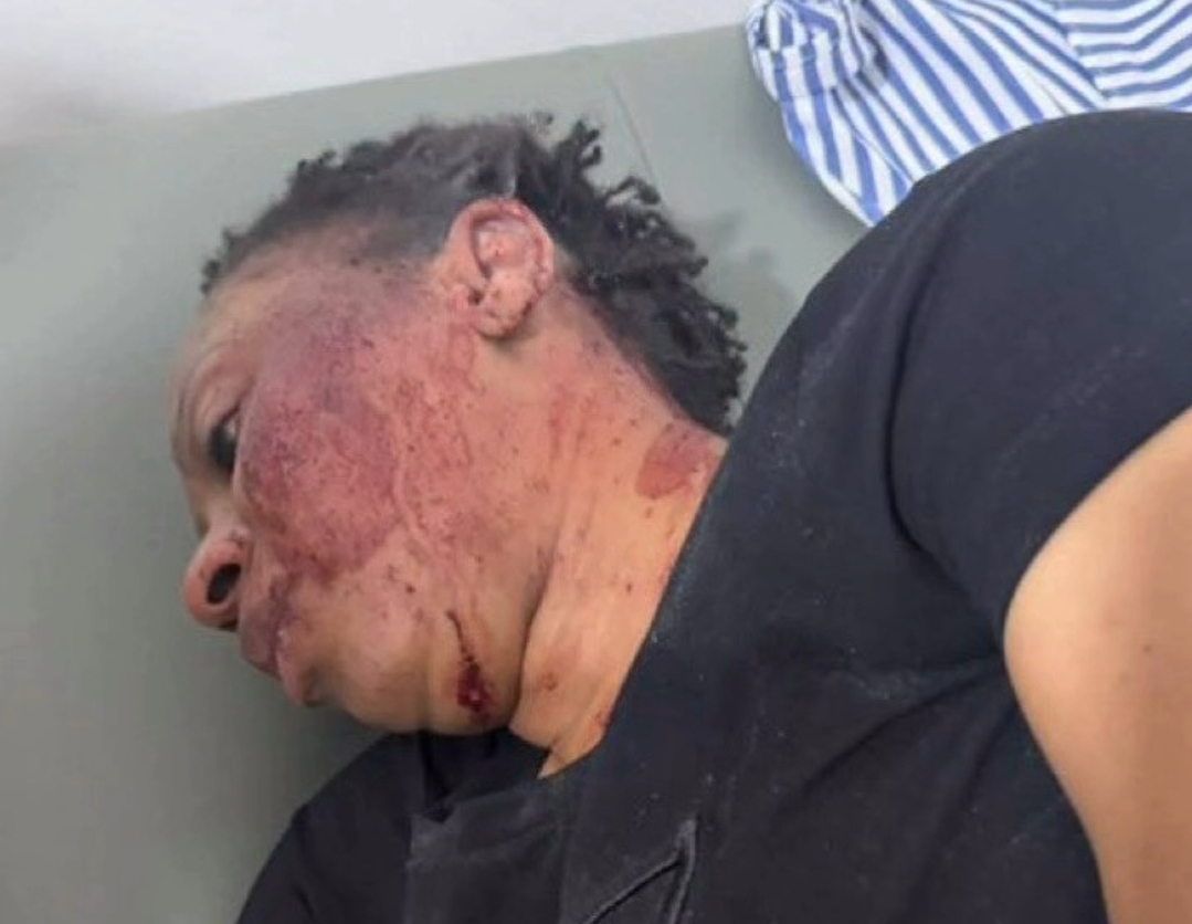 Six Private Security Guards Arrested Over Adwoa Safo Shooting Incident at Kwabenya